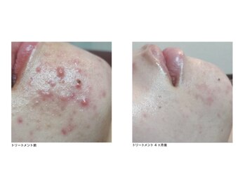 ジャミングレブ 六本木(jammmingrev)