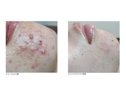 ジャミングレブ 六本木(jammmingrev)の写真