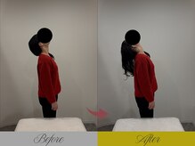 リン 大宮院(RIN)/骨膜整体での変化（担当：舘）