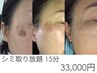 【人気NO.1】シミ集中ケア15分取り放題 33,000円