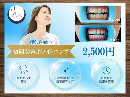 ムーンホワイトニング(Moonホワイトニング)の写真