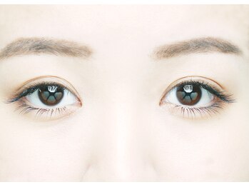 チャンプ 瓢箪山店(Champ)/After　120本　Nカール　￥9900