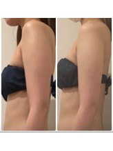 リズ(Liz)/PRセル