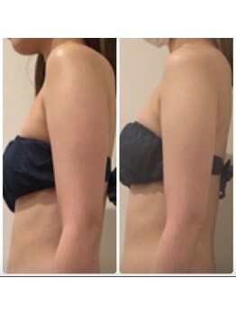 リズ(Liz)/PRセル