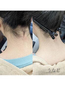 ワン(ONE)/うなじビフォーアフター♪