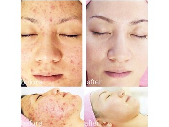 クリニカルエステクリア 梅田店