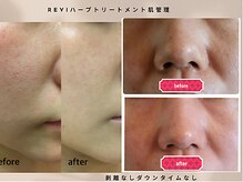 サロン ド グランツィア(salon de Granzia)
