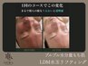 《プルプル水分量もち肌》ほうれい線予防★ LDM水玉リフティング単品