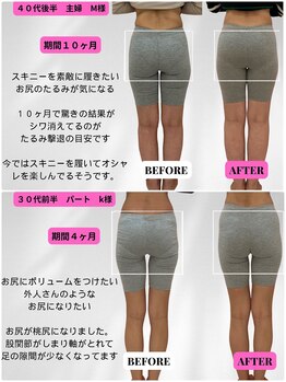 ビジリンヌ/ヒップアップ　広島市