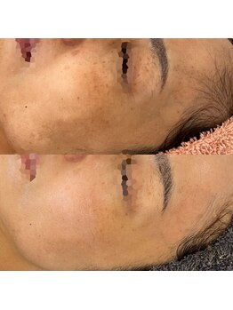 クラルテ(CLARTE)/今が1番キレイ!な肌作り♪