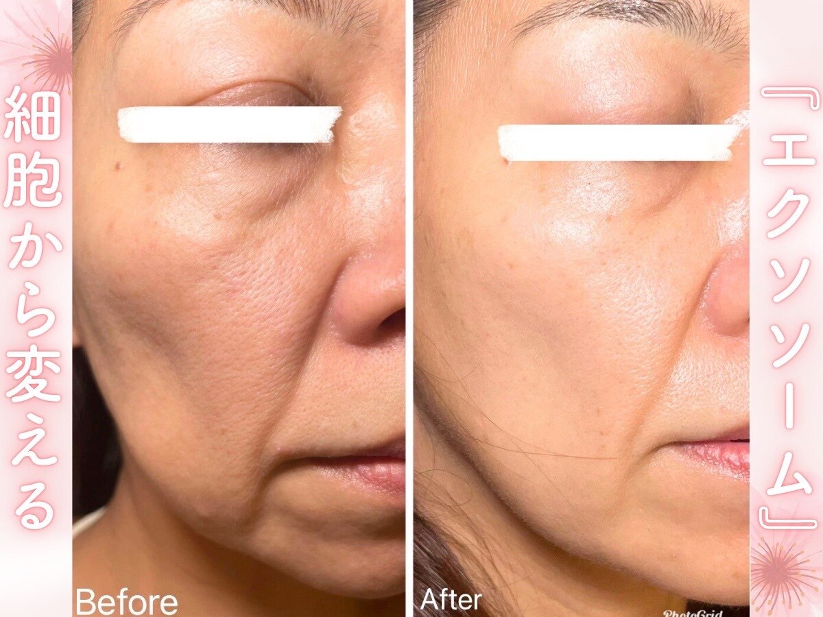 ニニ(nini)｜ホットペッパービューティー