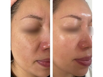 アスボーテ(ASBEAUTE)の写真