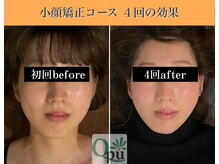 キュープ 表参道店(Qpu)/結果が出るから続けられる！