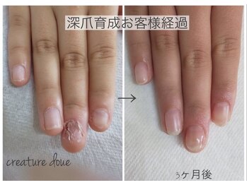 深爪育成お客様経過写真