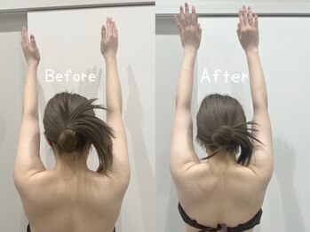 チャロアイト 可部店(Charoite)/筋膜リリース《メディセル美療》