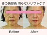【若見え印象◎】たるみ×ほうれい線特化の小顔矯正★90分￥18700→￥11000