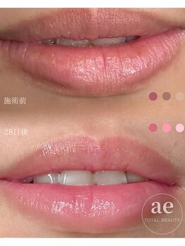 アエ(ae)/アフターケアでピンクを育てます