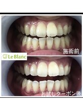 ルブラン 奈良店(Le Blanc)/効果実感できます！