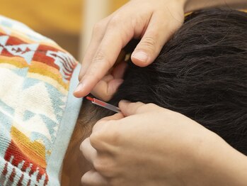 ネイビー鍼灸指圧治療院 那覇久米店(NAVY鍼灸指圧治療院)/指圧×鍼セットコース