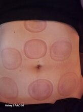 アール ピースア(R pii-suer)/カッピング/タイ古式マッサージ