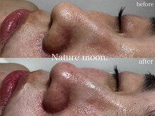ナチュールムーン(Nature moon.)/毛穴洗浄