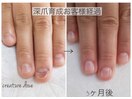 深爪育成お客様経過写真