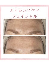 ピュアノア 垂水店 エイジング ケアエステ