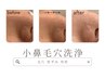 6月限定【ついでに美活♪】小鼻毛穴洗浄　¥1500→¥1000