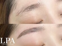 レピア 仙台店/韓国式LEPIA Before&Aｆter