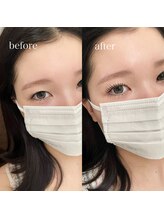 ウオン(uon)/ラッシュリフト上下