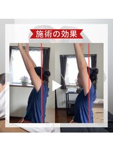 ギブ(GIVE)/4，施術後の肩の動きをチェック