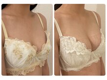 モナンジュ(ramonange)/バストアップ before after