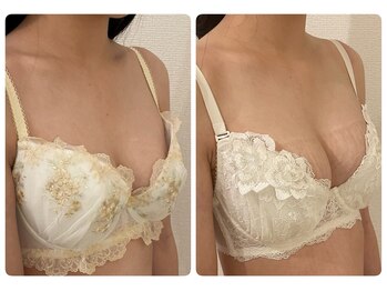 モナンジュ(ramonange)/バストアップ before after