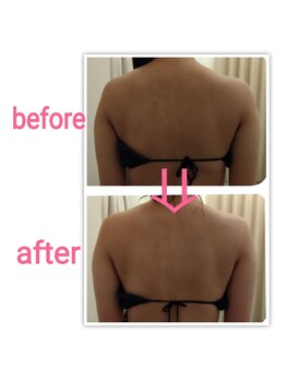 マールム(MALUM)/ブライダル　ケア