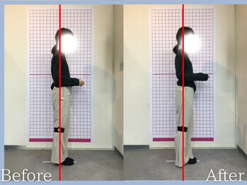 トロ整骨院(toro整骨院)/★骨格矯正(1回)★産後30代女性