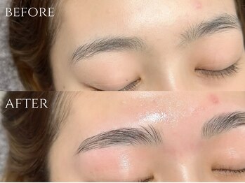 エルミュ(Elmu)/ハリウッドブロウリフト