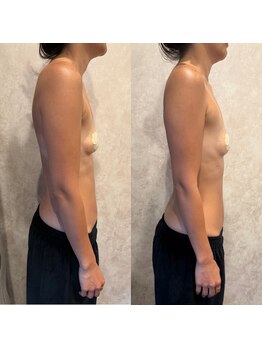 ブリア 横浜(BRILLA)/美乳になりたい方！！