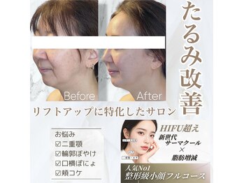 ルミライ(Lumirai)