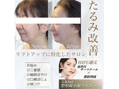 ルミライ(Lumirai)の写真