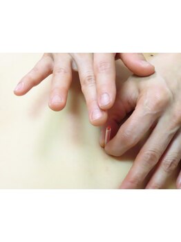 鍼灸施術を受けたい