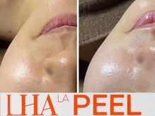 [DTなし]ララピール導入店！新松戸駅/ララピール