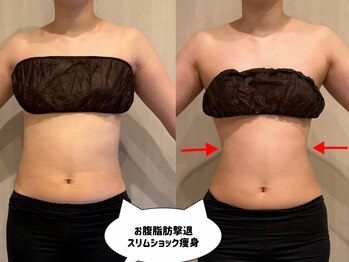 リングケー(Ling K)/お腹集中引き締め