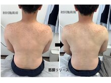 メディカルサロンドオフ 堺東店(medical salon de off)/筋膜リリース♪ビフォーアフター