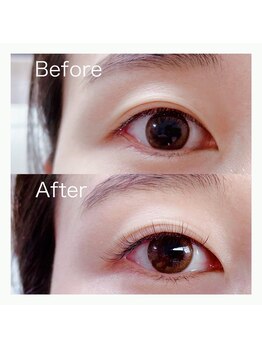 ビオラス(Biolus)/ソエルラッシュでナチュラルEye!