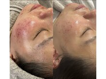 アイアール(ir)/