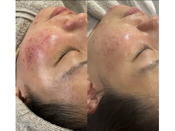 アイアール(ir)/