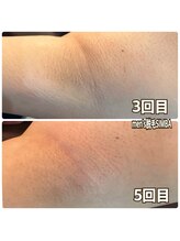 シンバ 倉敷店(SIMBA)/