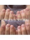 ご来店当日から深爪が緩和