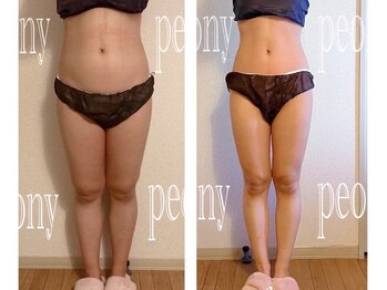 ピオニー(PEONY)/【痩身】全身燃焼スリムコース