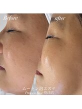 プリンセスローズ 焼津店(Princess Rose)/ムートン泡エステ